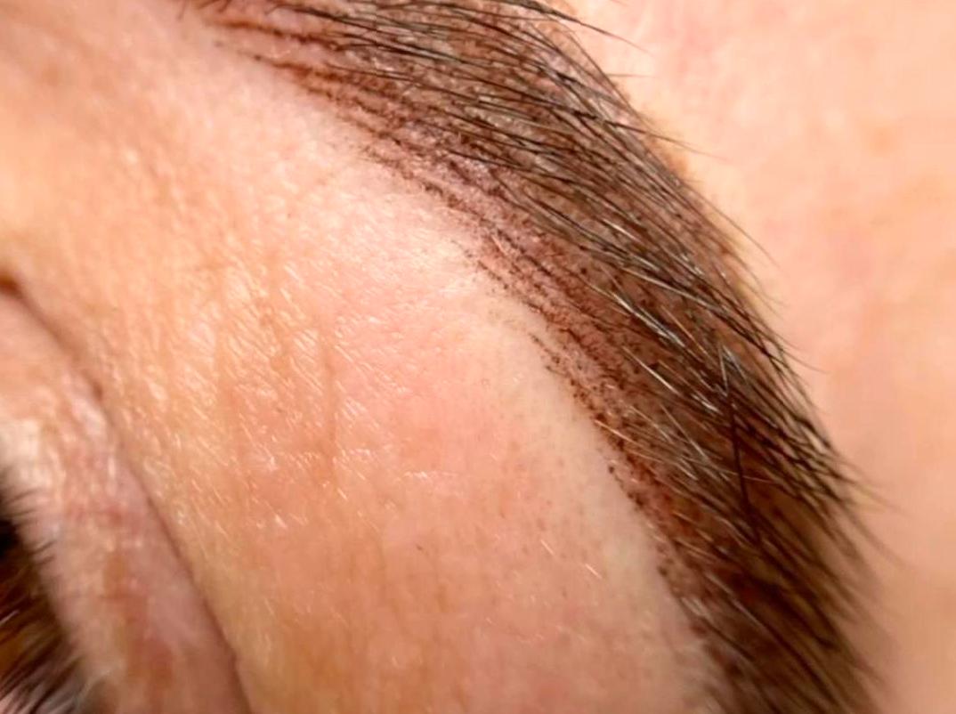 Approaches to Eyebrow Tattooing